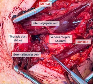 Surgical field after bypass